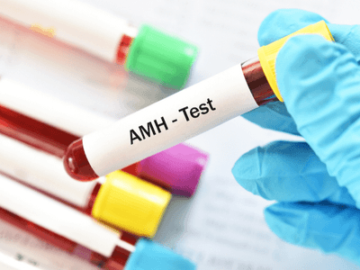 AMH Test | Anti Mullerian Hormone Blood Test For Ovarian Reserve